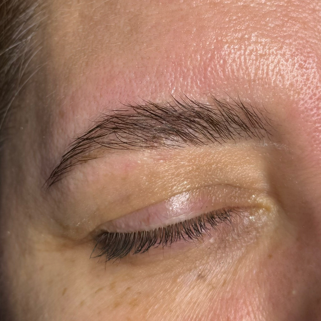 Аппаратное восстановление бровей