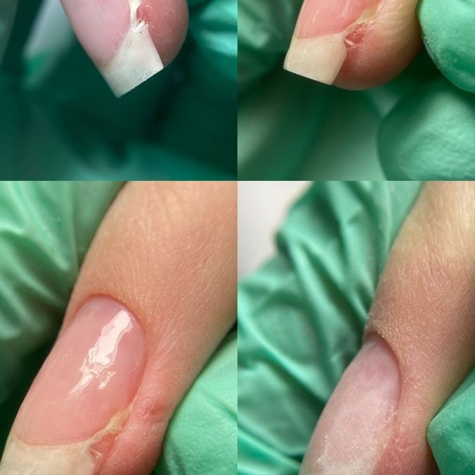 Ремонт 1 ногтя