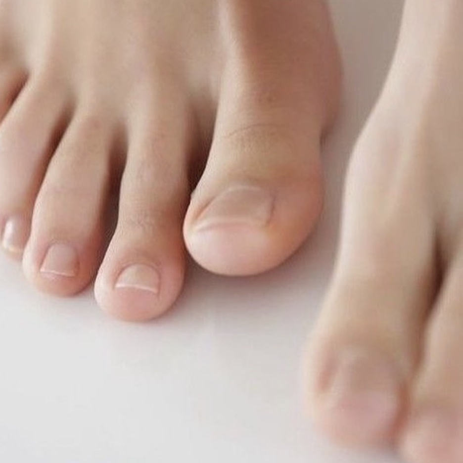 Подология. Обработка бородавки 1 единица