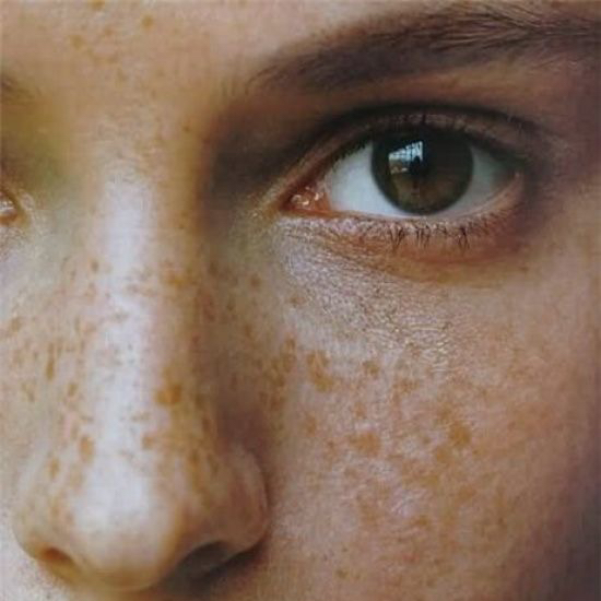 Пилинг с транексамовой кислотой