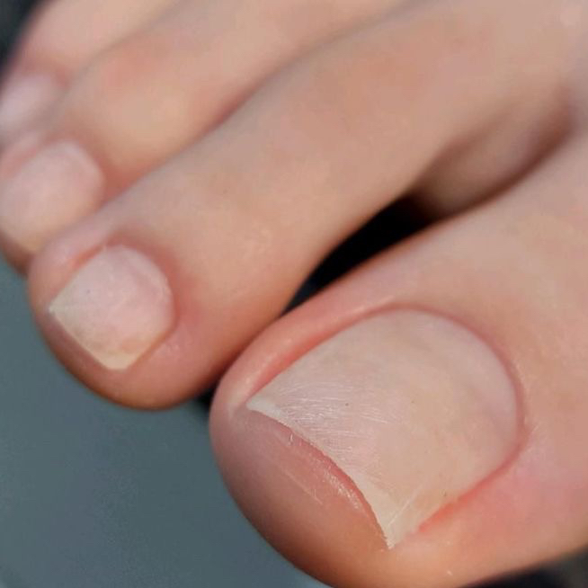 Экспресс педикюр