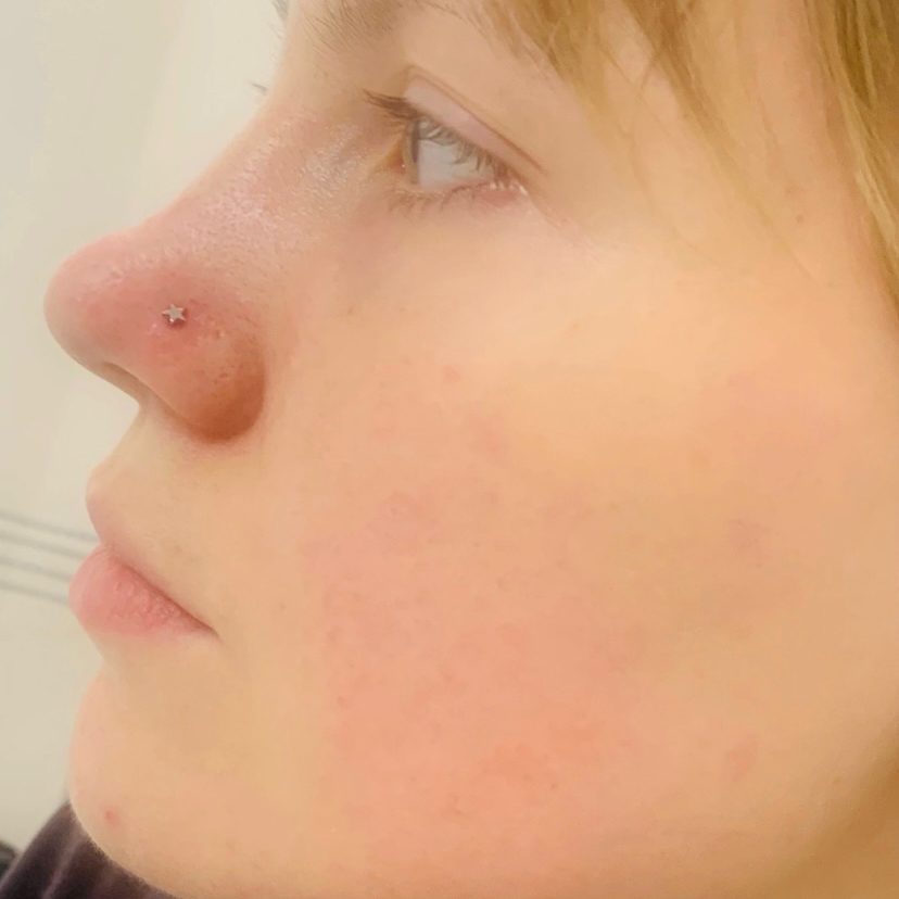 Пирсинг Крыло носа