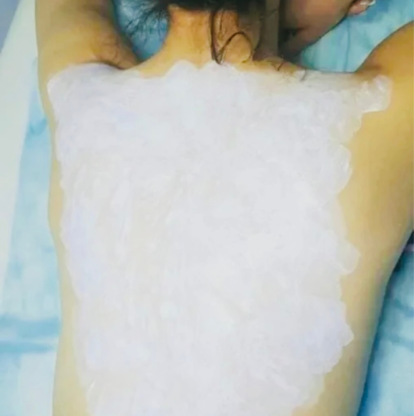 Чистка спины