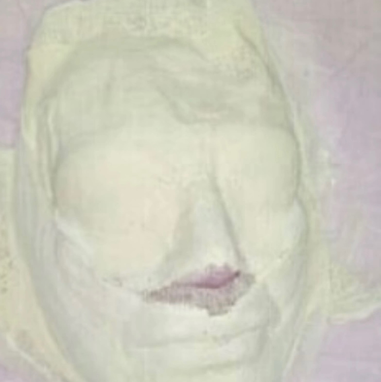 Гипсовая маска