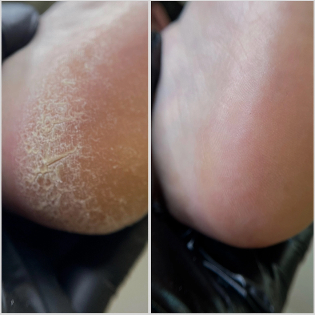 педикюр «стопы+покрытие»