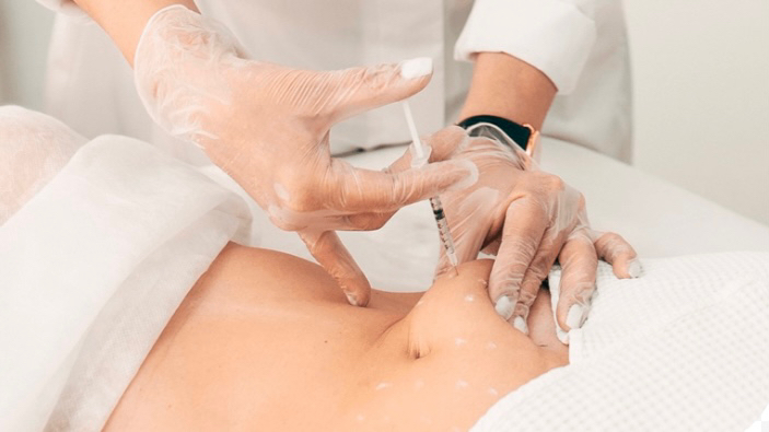 Мезотерапия тела