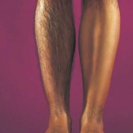 Депиляция Ног голень / бедро