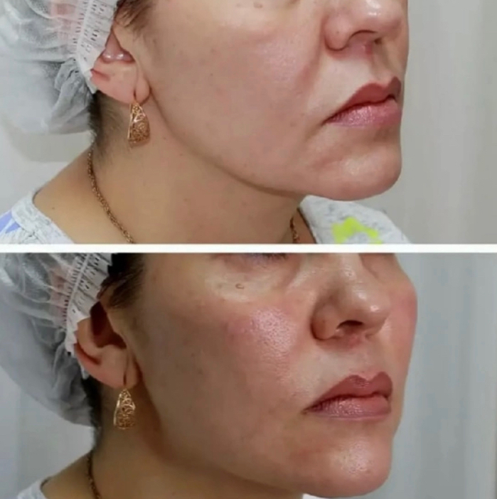 МОНАКО мезококтейль