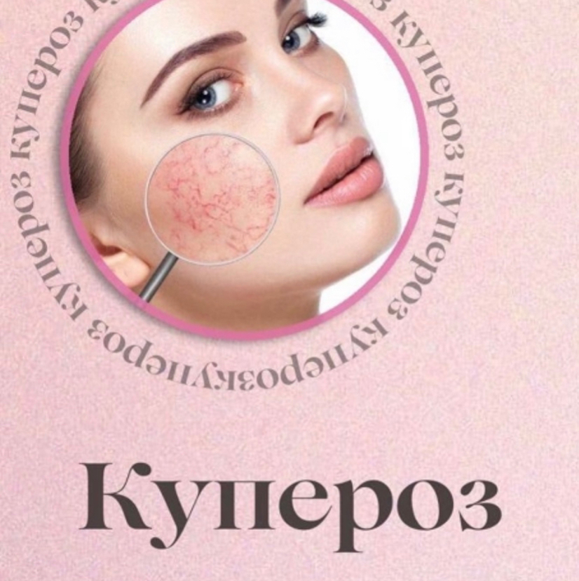 Комплекс «Антикупероз»