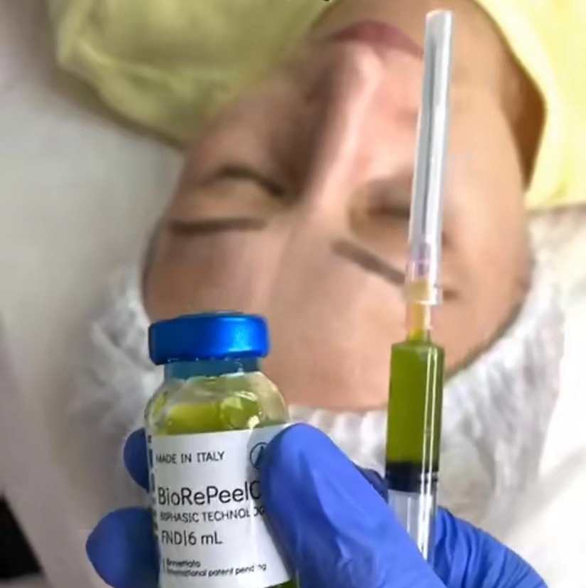 Биоревитализация без инъекций