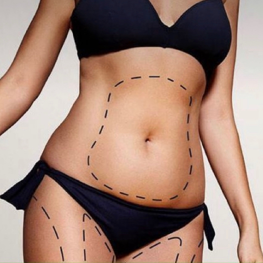 Комплекс для тела «Стройность»