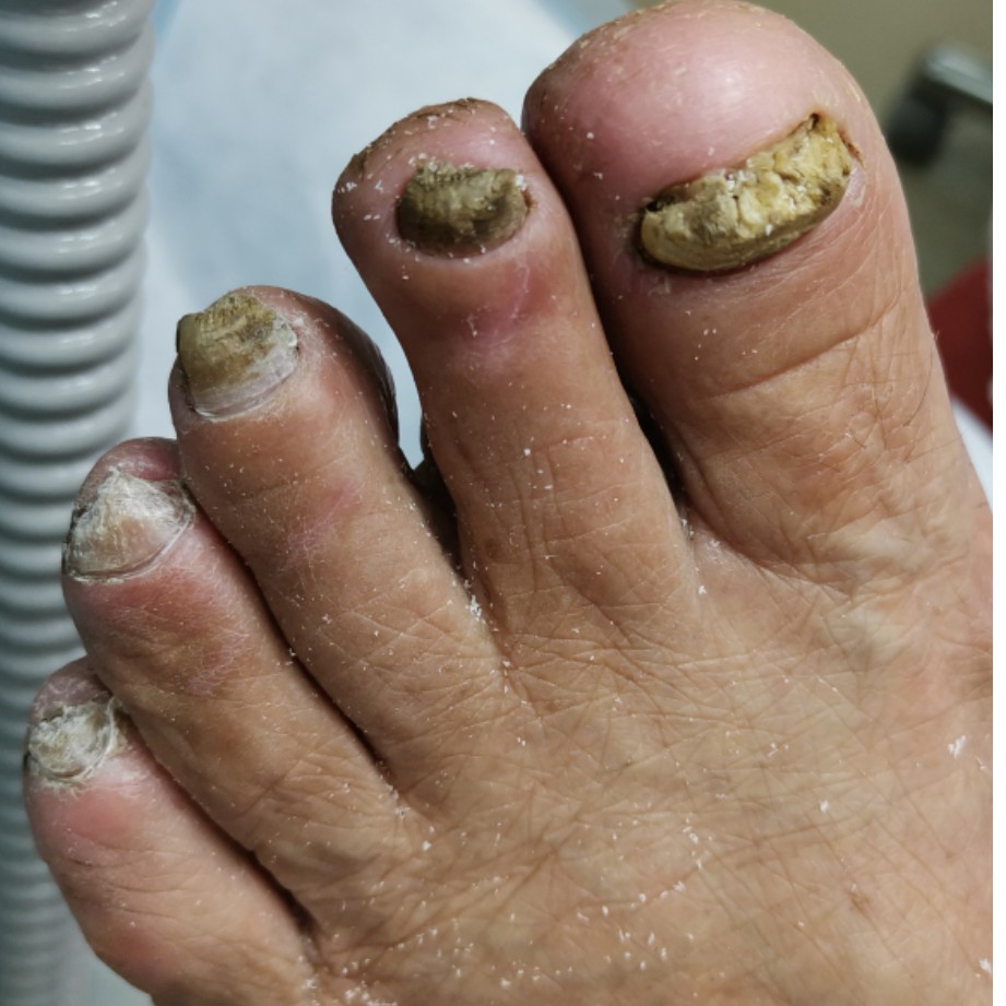 Обработка сложных ногтей