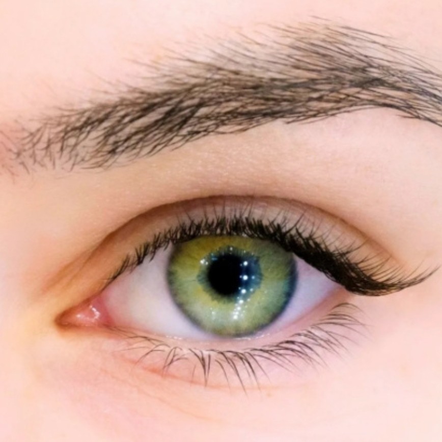 Уголки наращивание