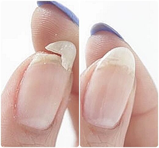 Ремонт 1 ногтя (трещина, уголок )