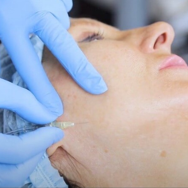 инъекционная карбокситерапия СО2 мед газ высокой очистки