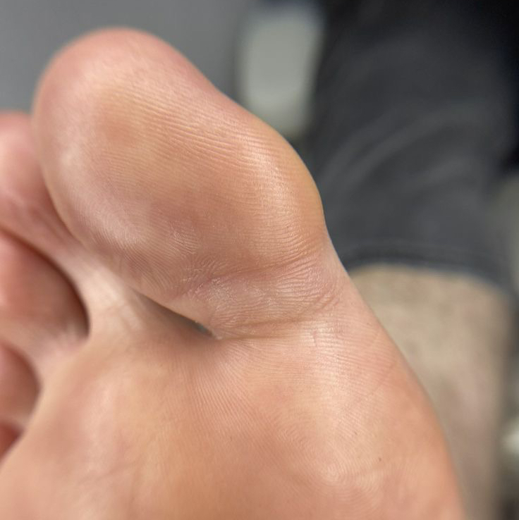 Мужской педикюр