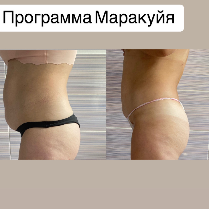 Акцент на живот