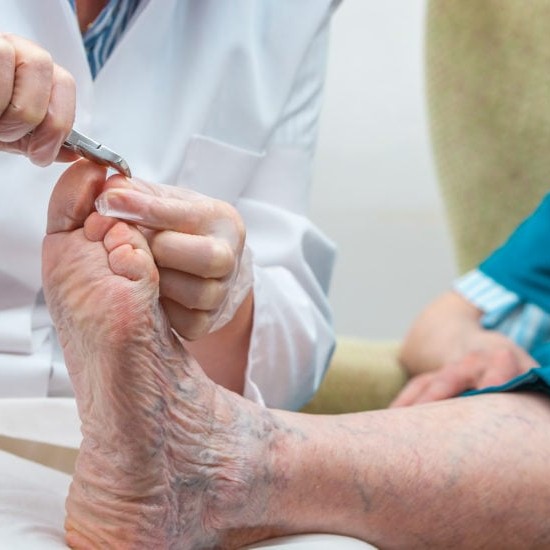 Педикюр для пожилых на дому