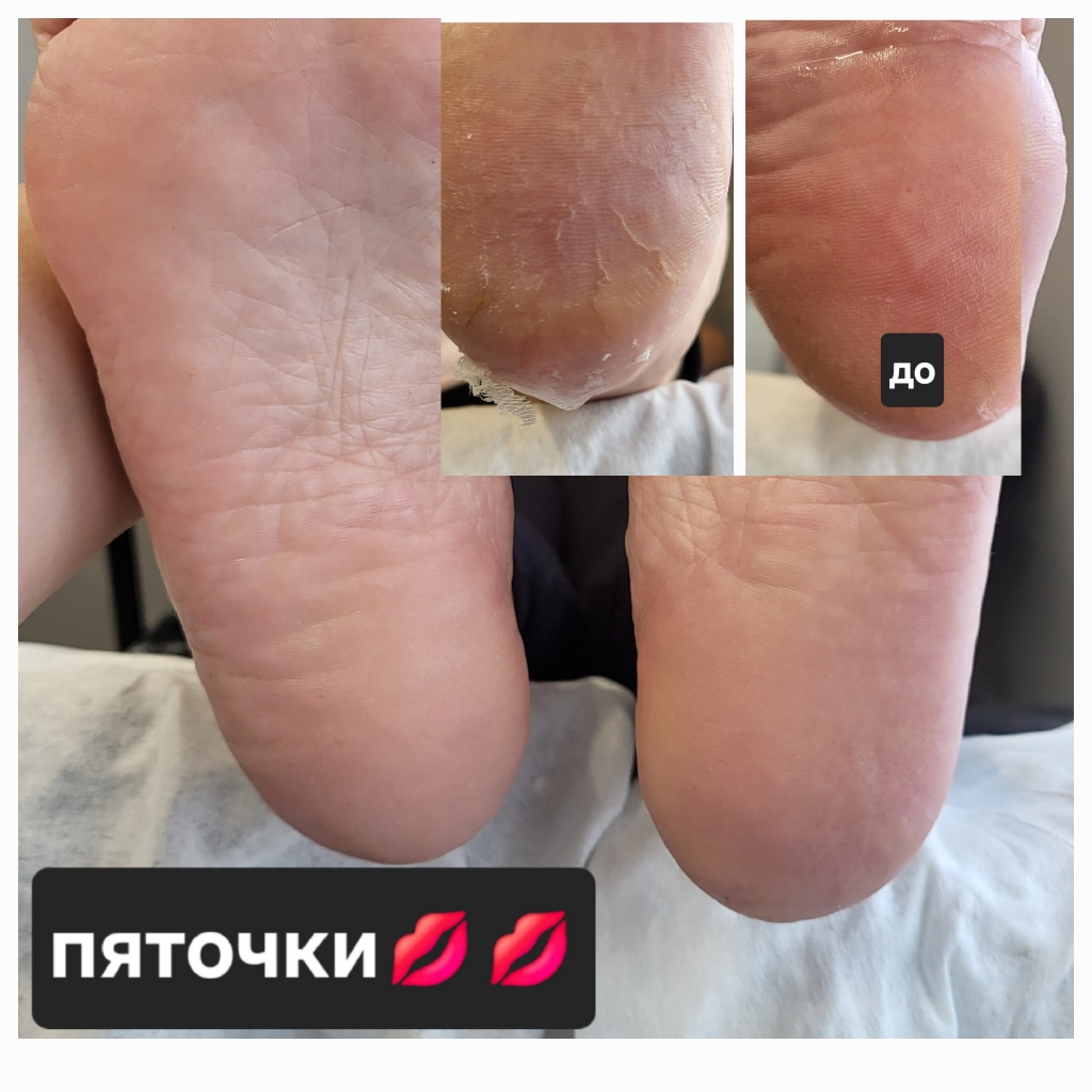 Педикюр гигиенический полный