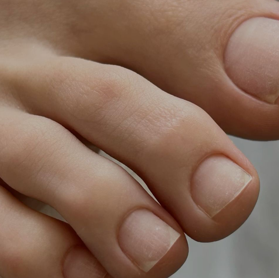 Снятие чужого покрытия