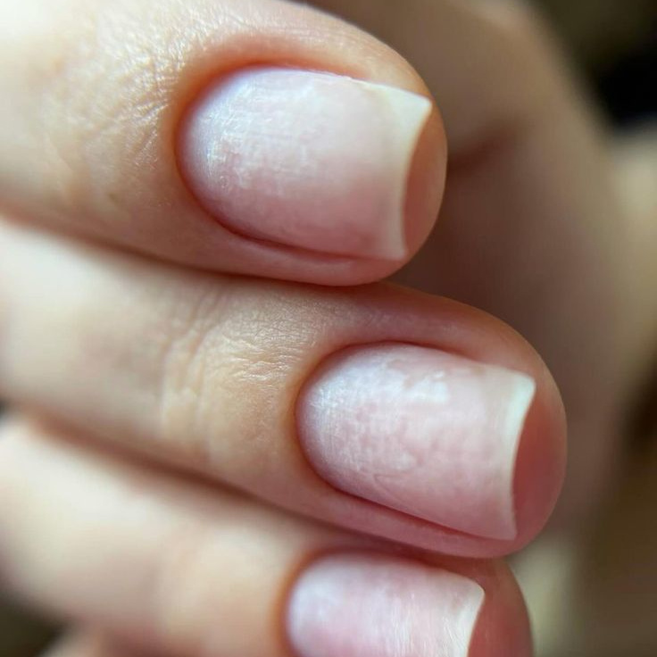 Гигиенический комбинированный женский маникюр с лечебным покрытием