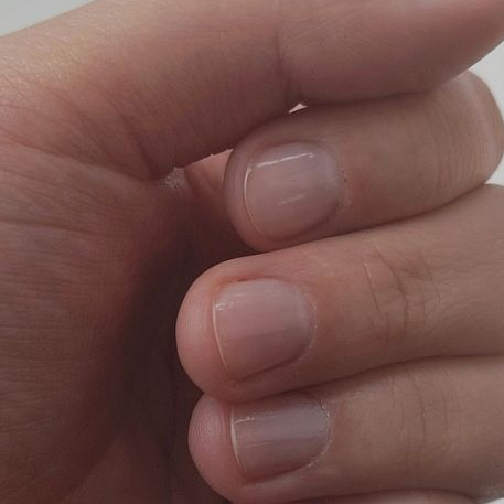 Снятие без последующего покрытия+придание формы