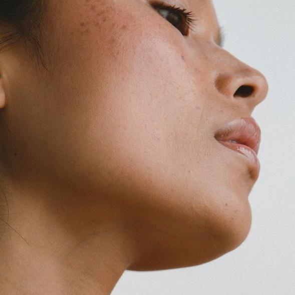 Удаление волос с подбородка