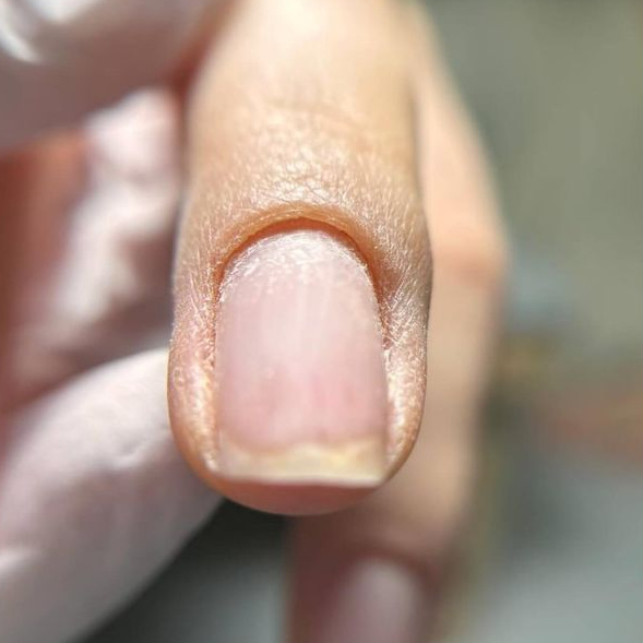 Снятие искусственных ногтей + комби маникюр + лечебный лак