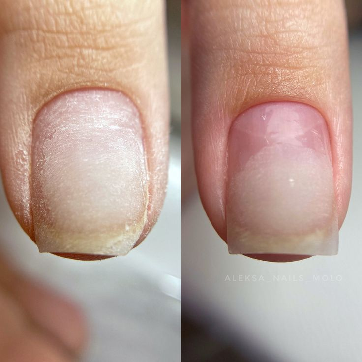 Ремонт ногтя ( углов/длинны/трещин)