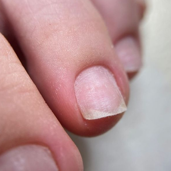 Снятие покрытия + обработка пальчиков без покрытия