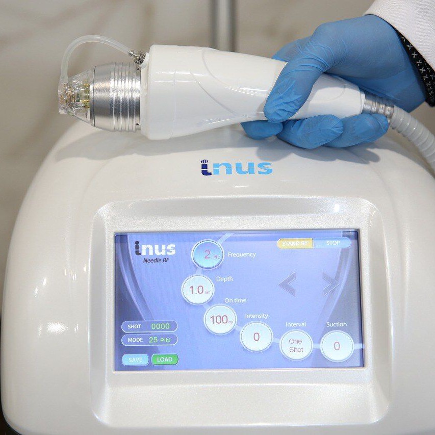 бедра+ ягодицы  RFЛифтинг микроигольчатый