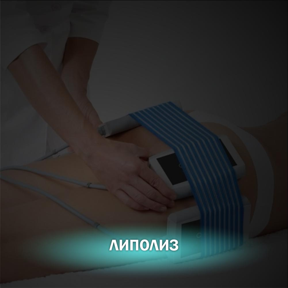 Лазерный липолиз