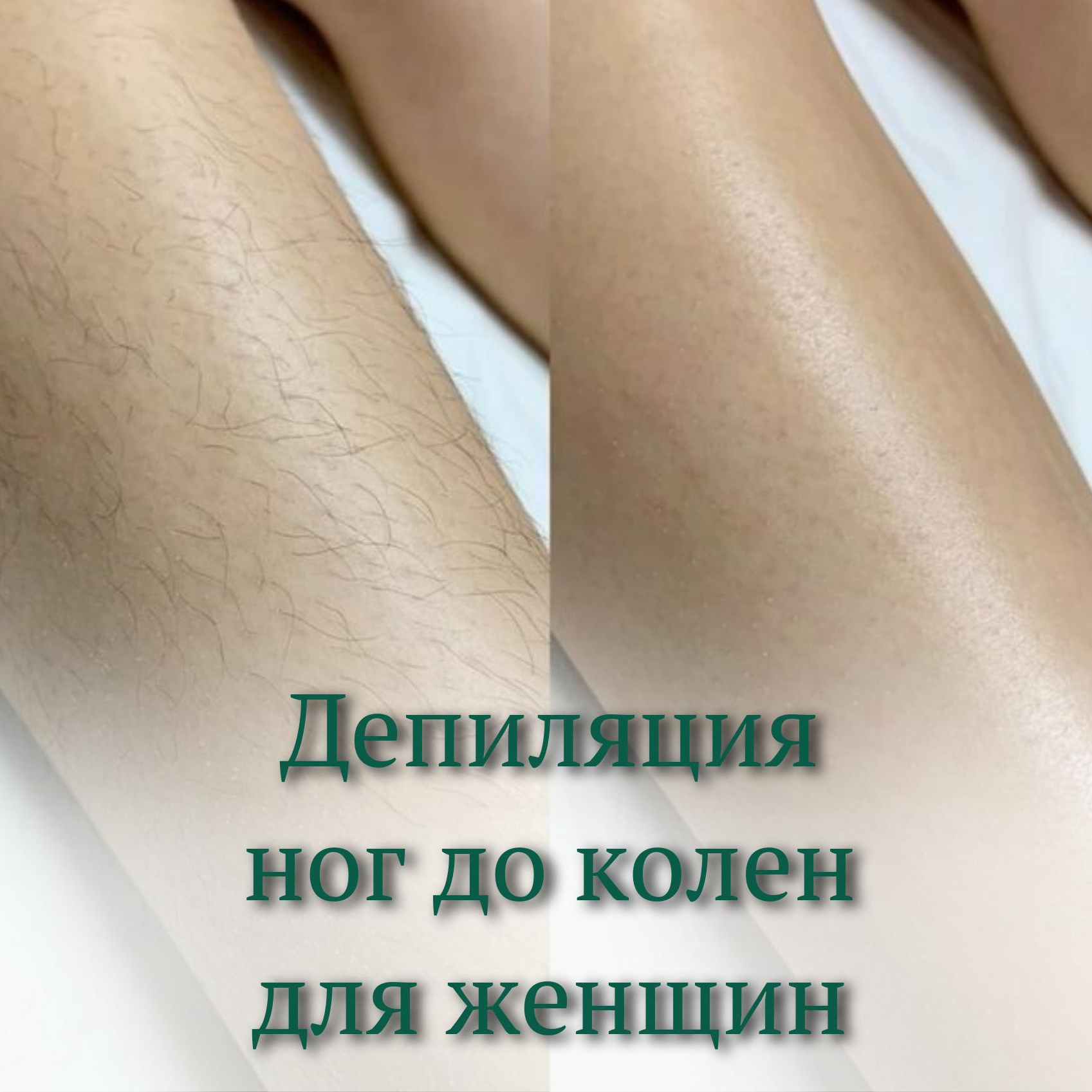 Депиляция ноги до колен