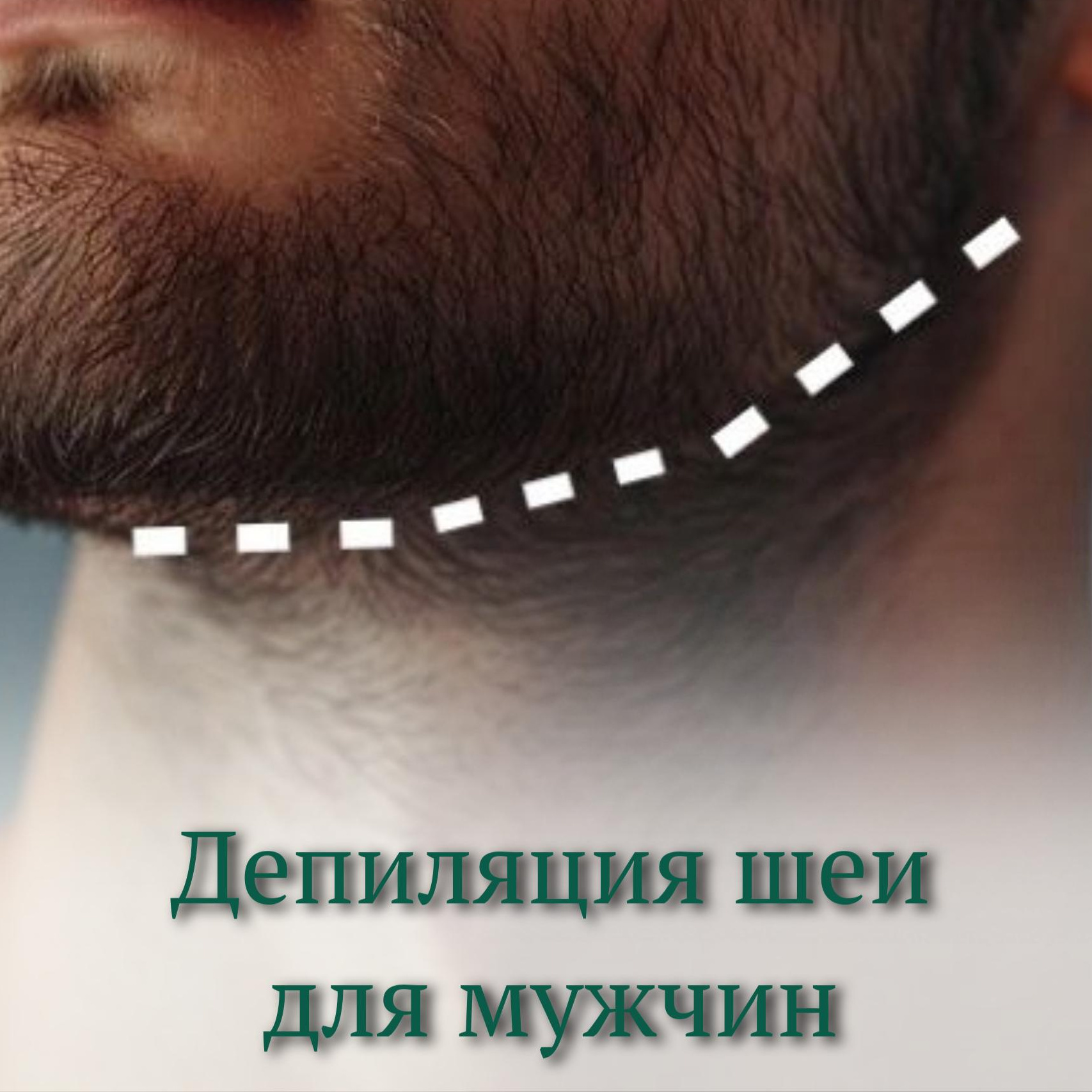 Мужская депиляция шея