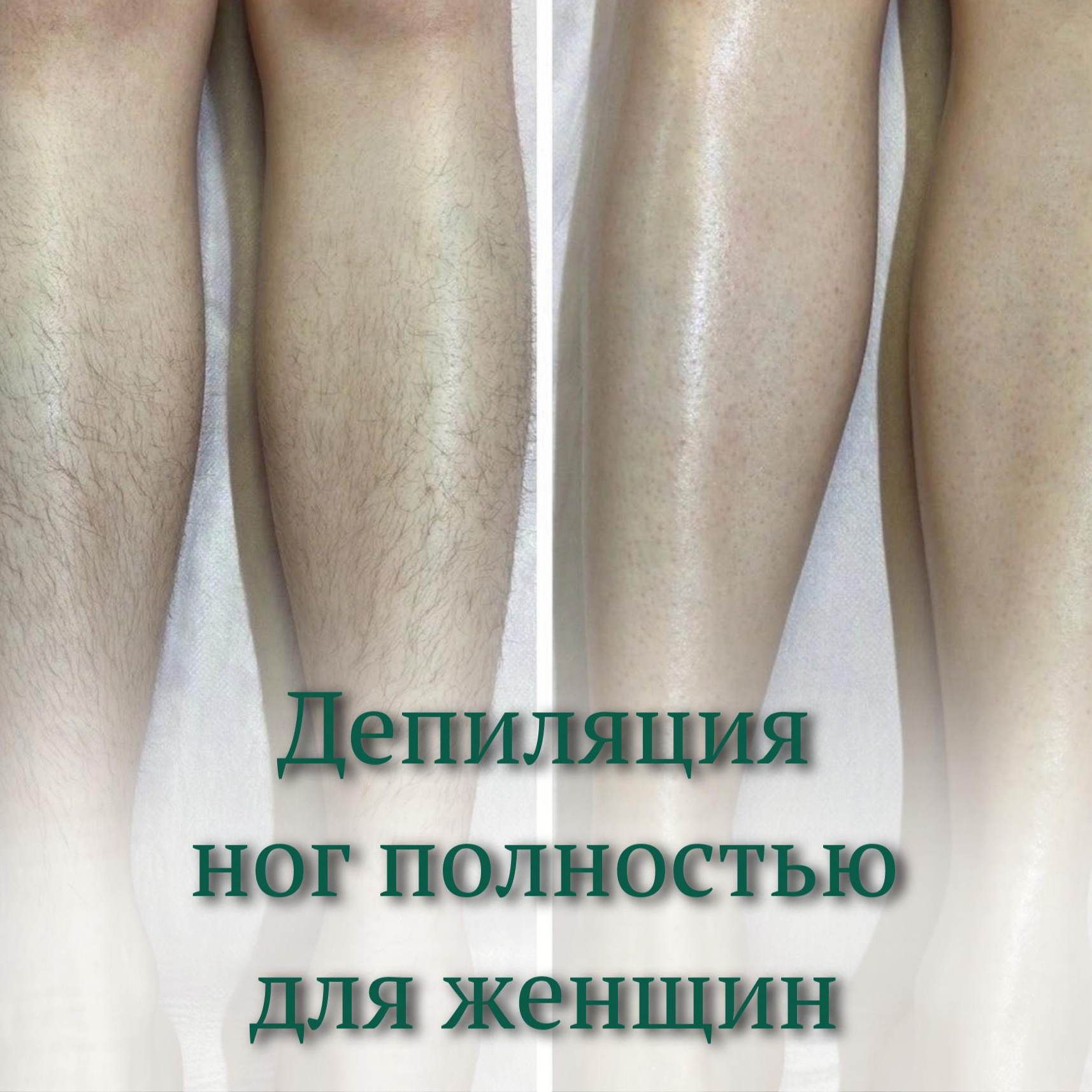 Депиляция ноги полностью