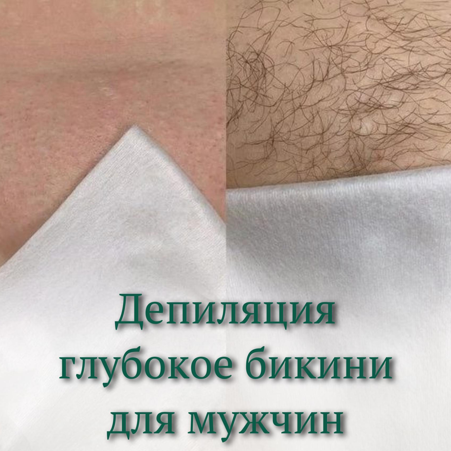Мужская депиляция глубокое бикини