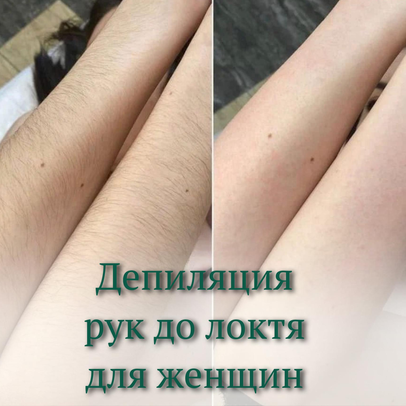 Депиляция руки до локтя