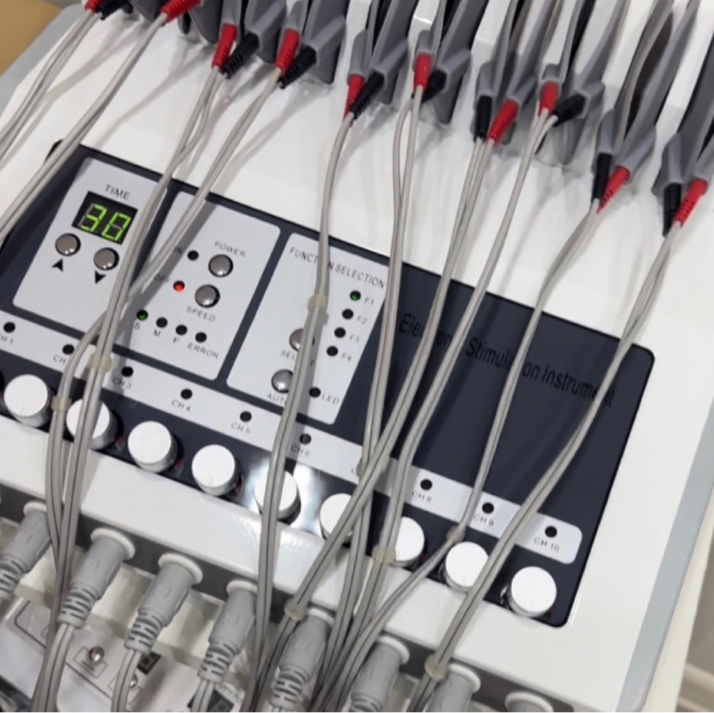 Миостимуляция