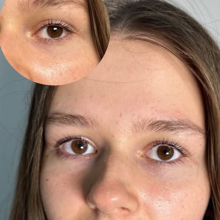 Laminarea Genelor + Vopsire + Botox