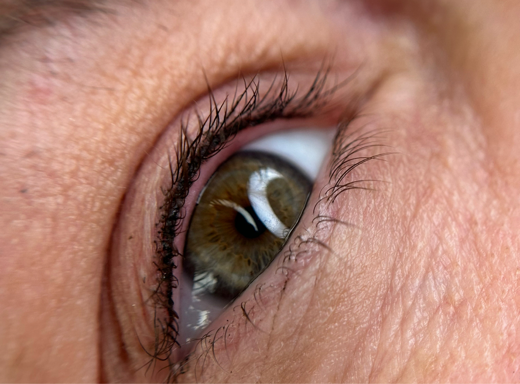 Межресничка