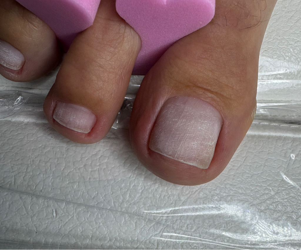 Гигиена пальцев ног