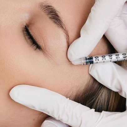 Биоревитализация лицо