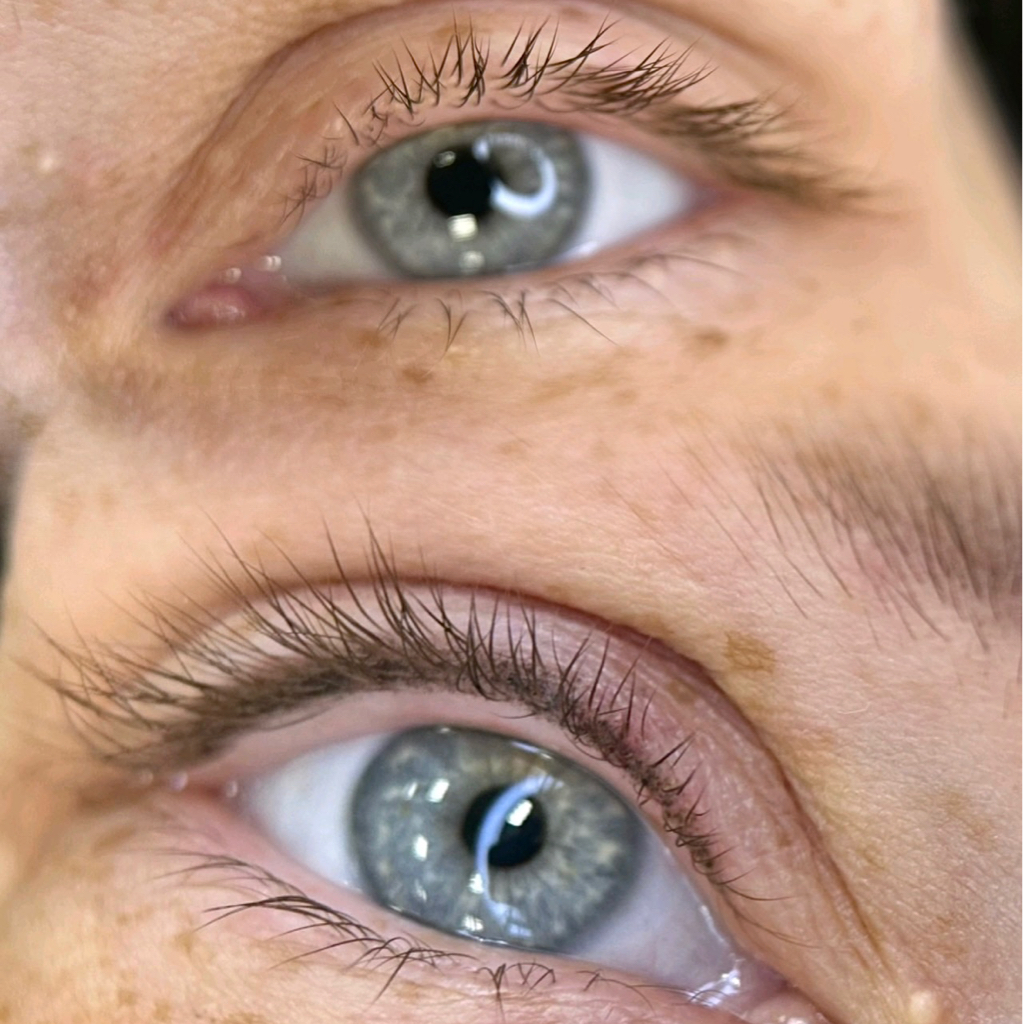 Обновление Межресничка