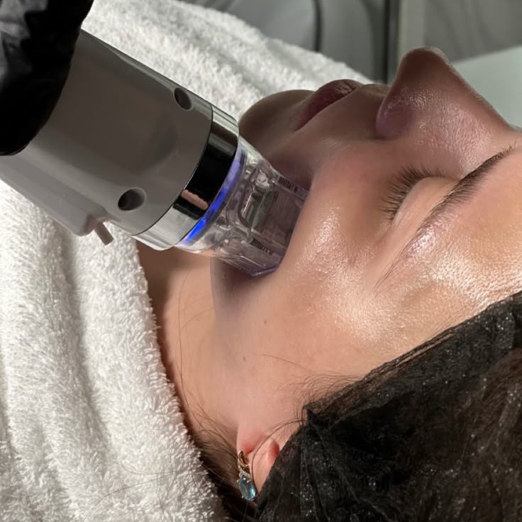 АКЦИЯ!!!МИКРОИГОЛЬЧАТЫЙ РФ-ЛИФТИНГ-ЛИЦА, ШЕИ, ДЕКОЛЬТЕ(мощное омоложение лица, шеи, декольте)8000т.р(вместо 12000т.р.)
Сентябрь, октябрь, ноябрь! Осен