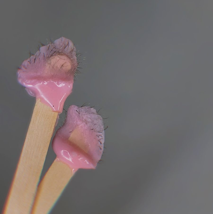 Удаление волос в носу