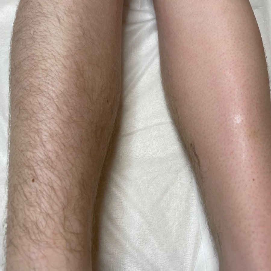 Бикини глубокое+ноги полностью+подмышки+руки