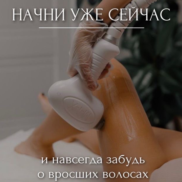 Лазерная эпиляция
