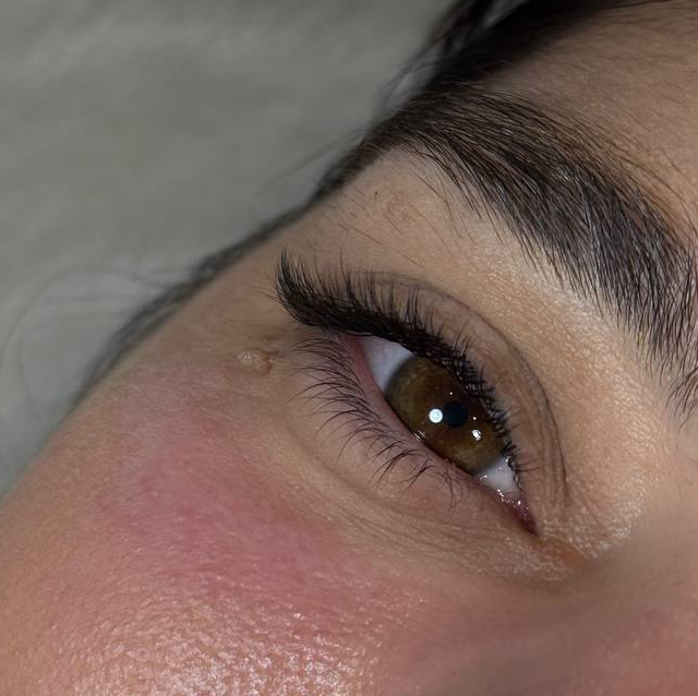 Коррекция классического объема