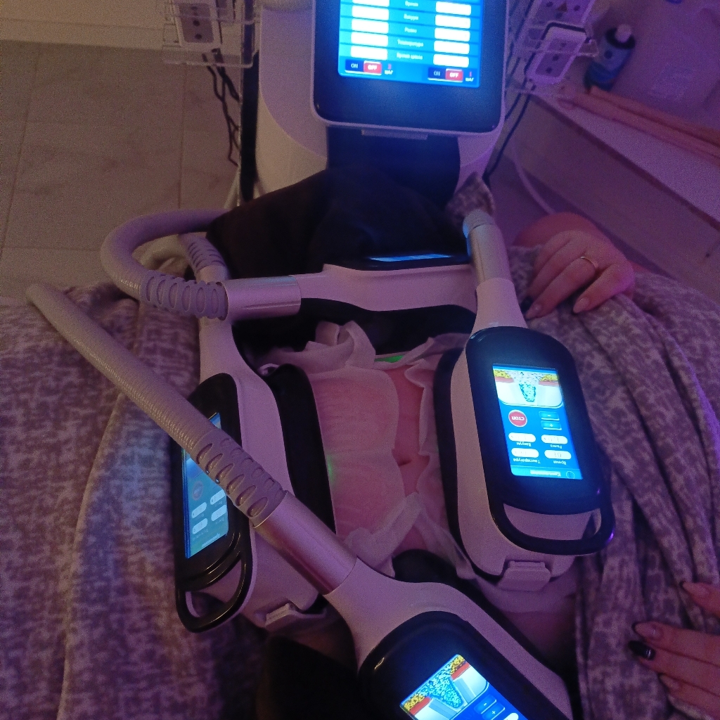 Абонемент на 10 манипул криолиполиз