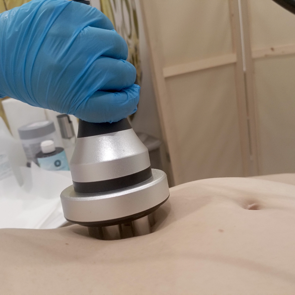 абонемент на RF-лифтинг по телу на 10 сеансов